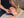 Acupuncture