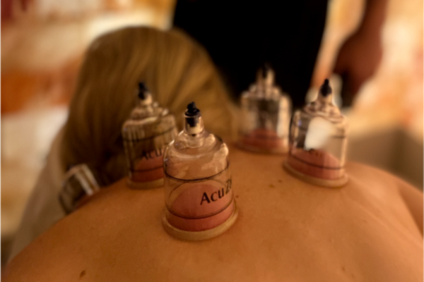 cupping therapy eastern medicine FloLo Holistic